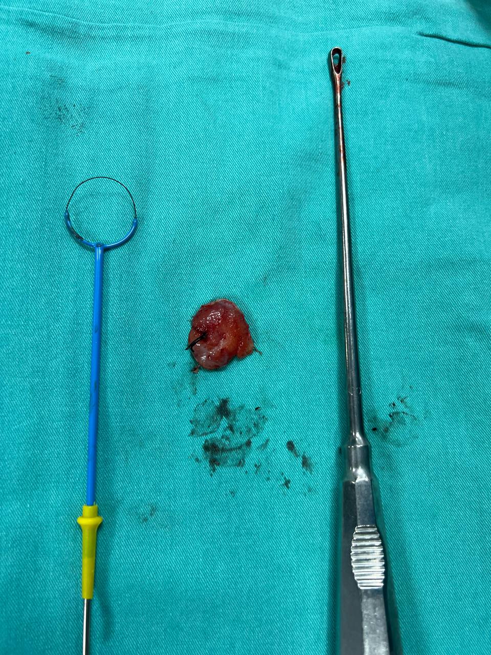 İşlem sonrası specimen materyal örneği