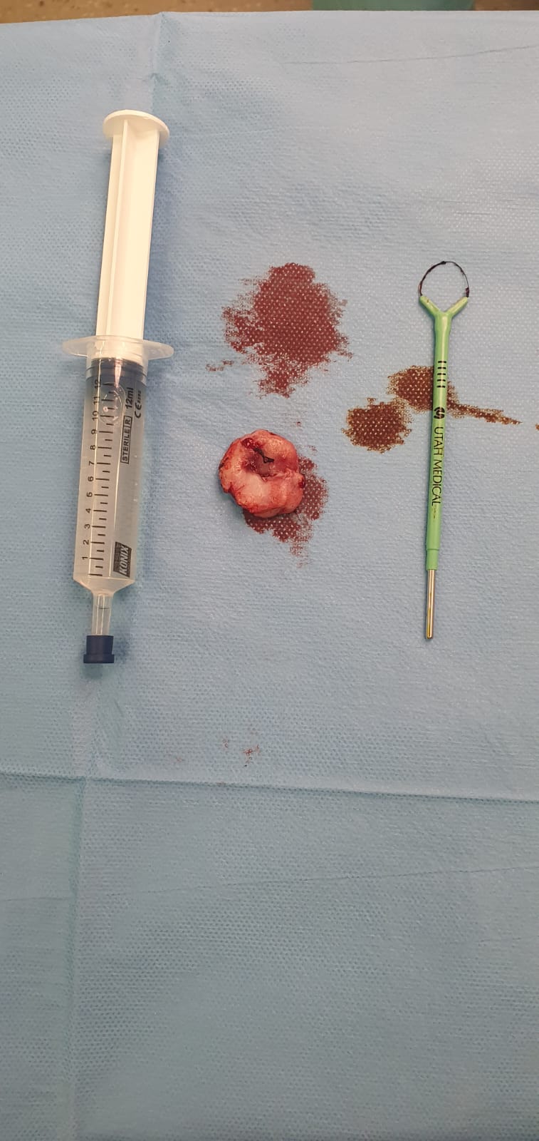 İşlem sonrası specimen materyal örneği