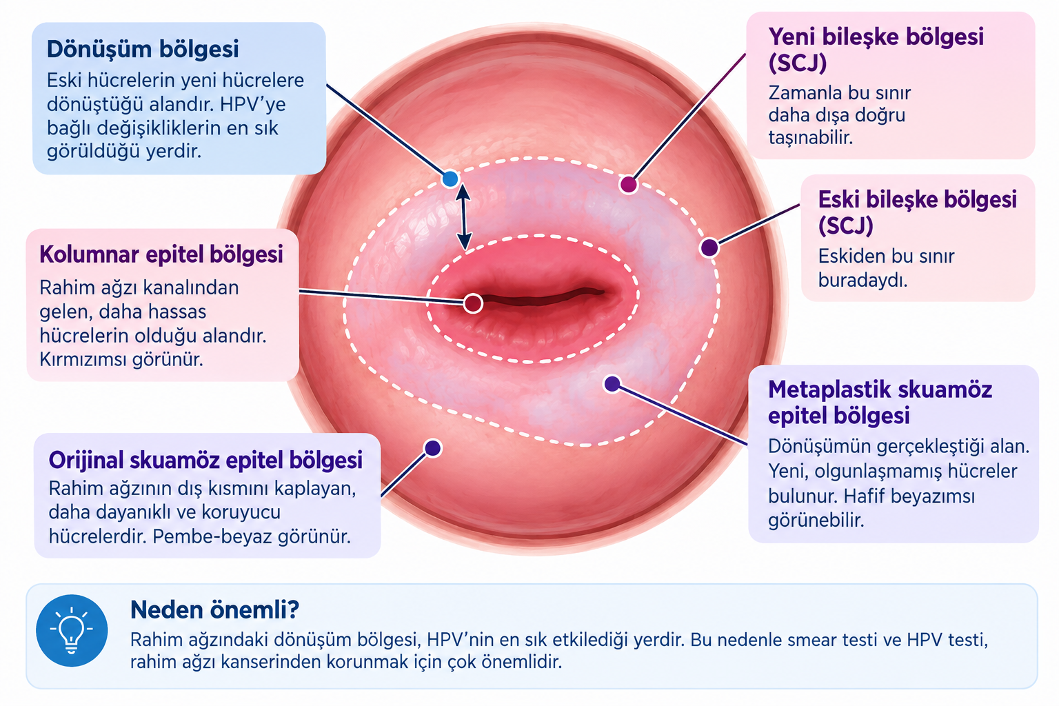 Rahim ağzı dönüşüm bölgesi görseli